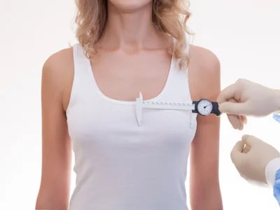 Warum die Bauchdeckenstraffung eine beliebte Wahl in der plastischen Chirurgie ist
